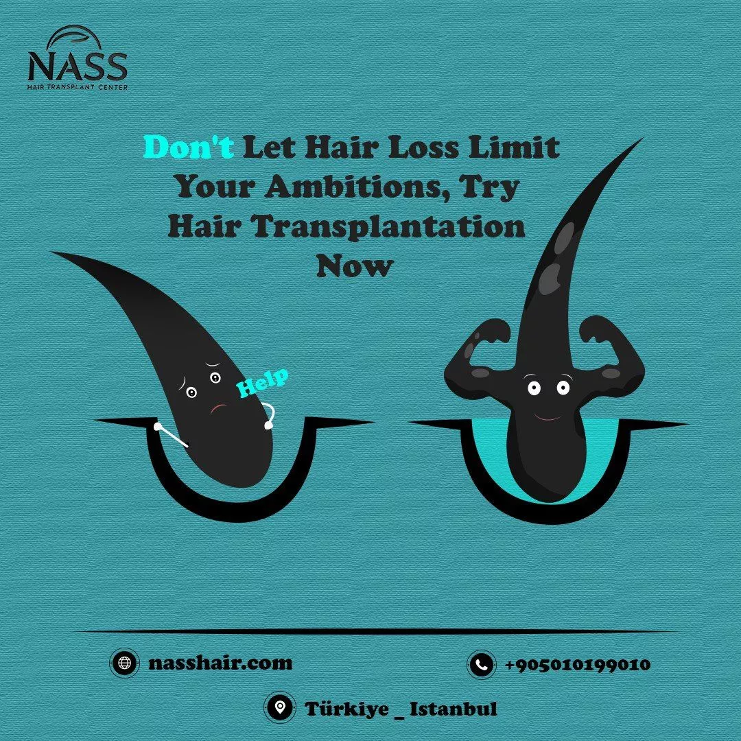 hair transplantation clinic