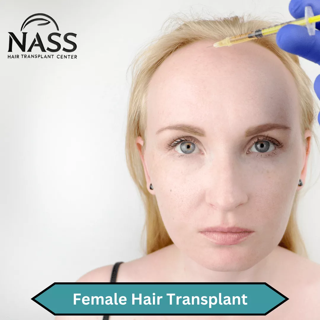 Female Hair Transplant