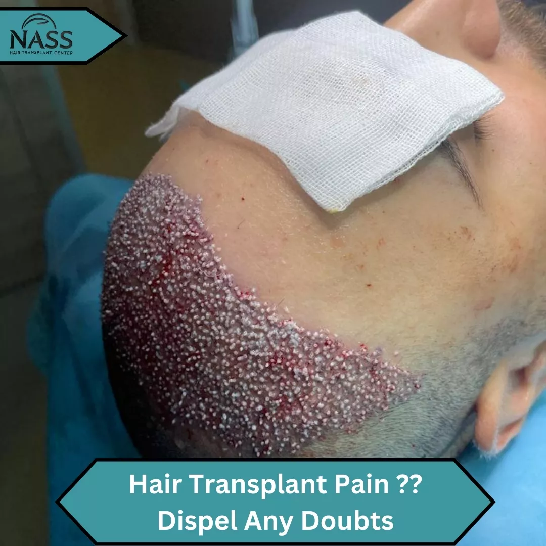 Hair Transplant Pain