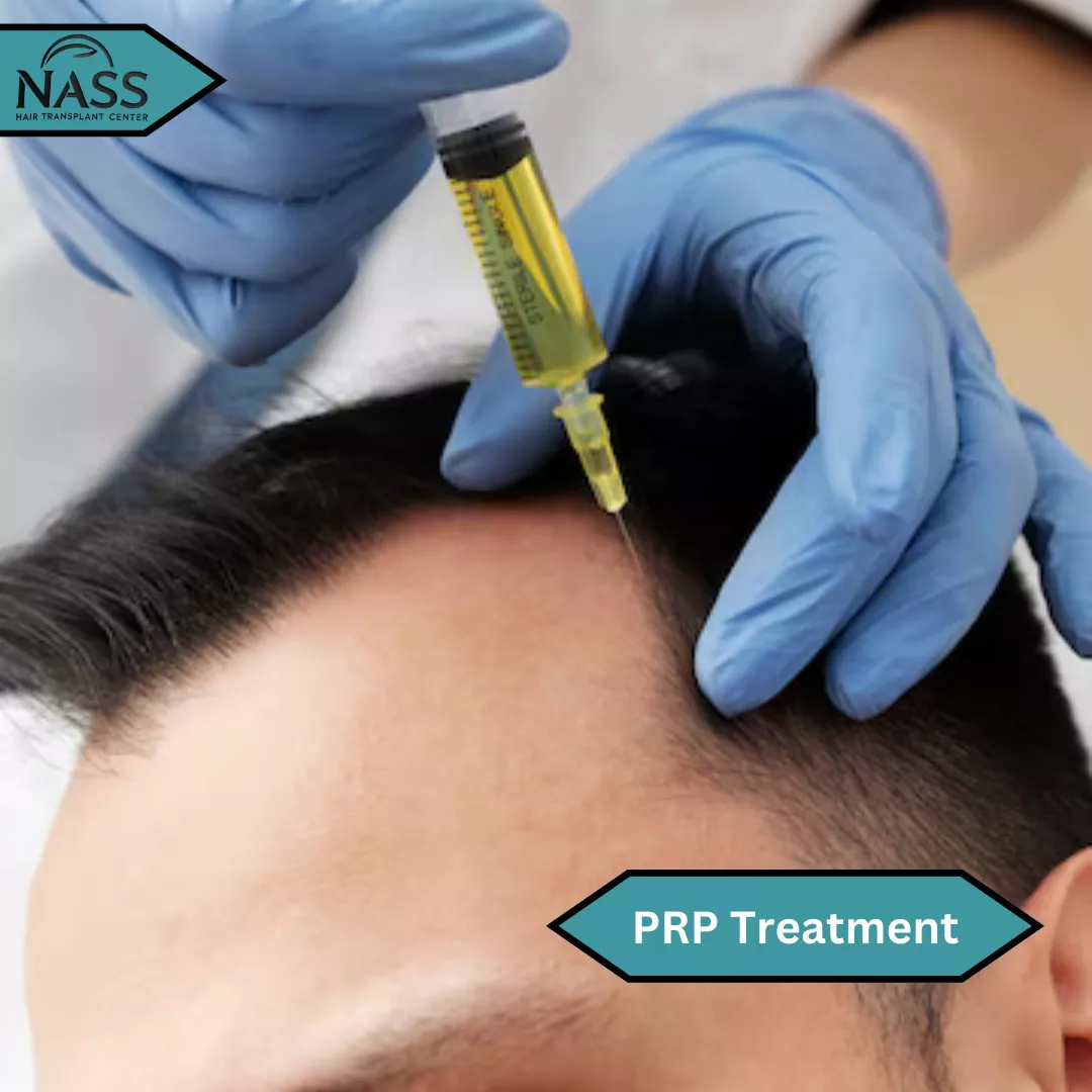 PRP treatment