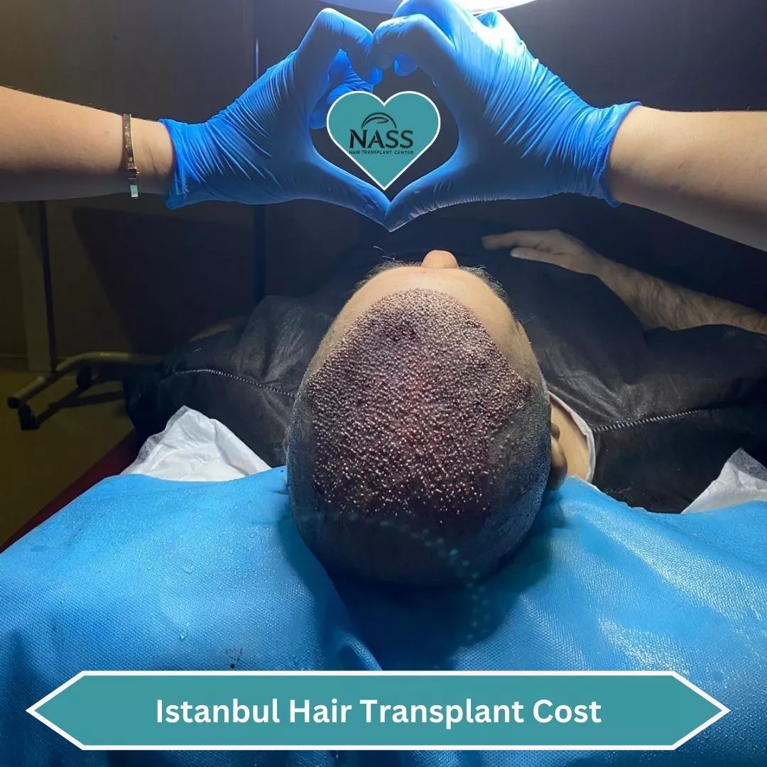 Hair Transplant Aftercare