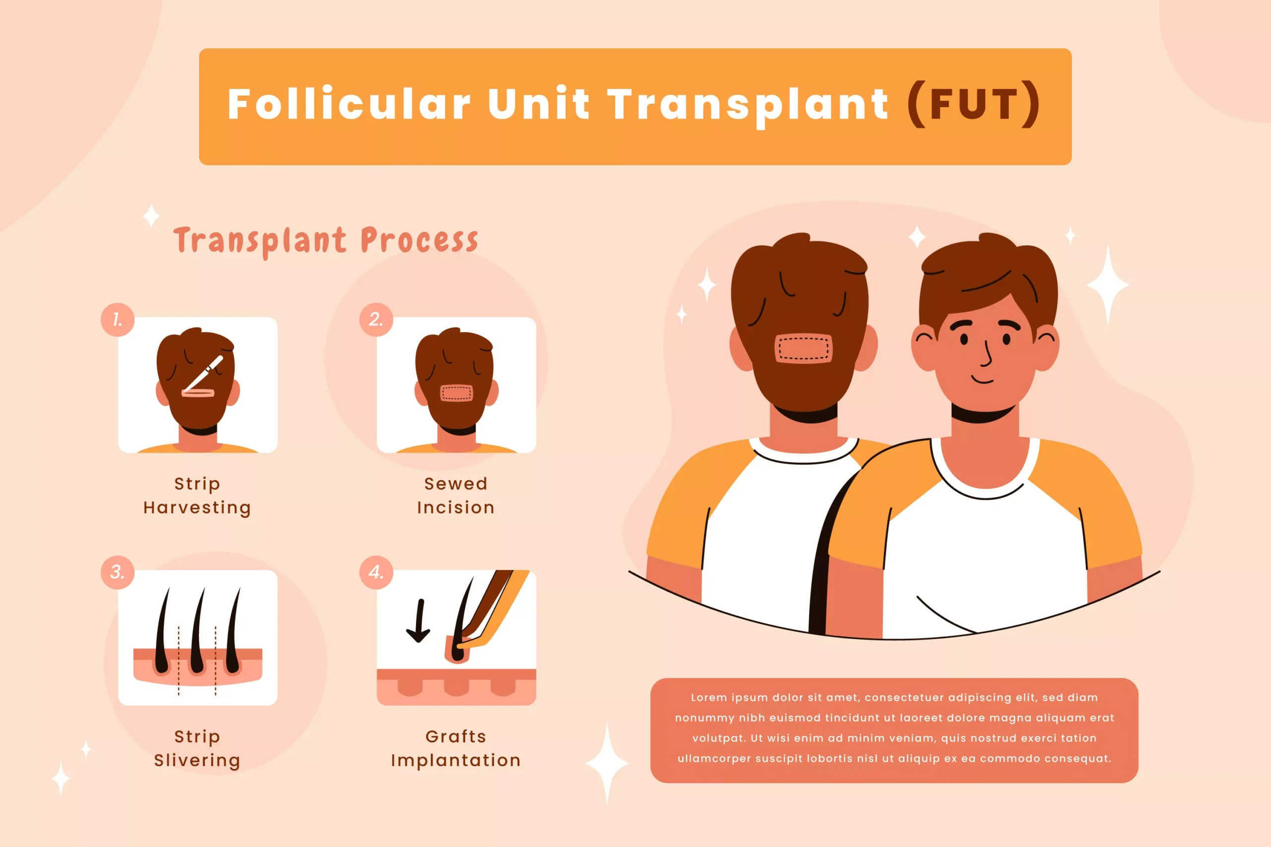 fut hair transplant