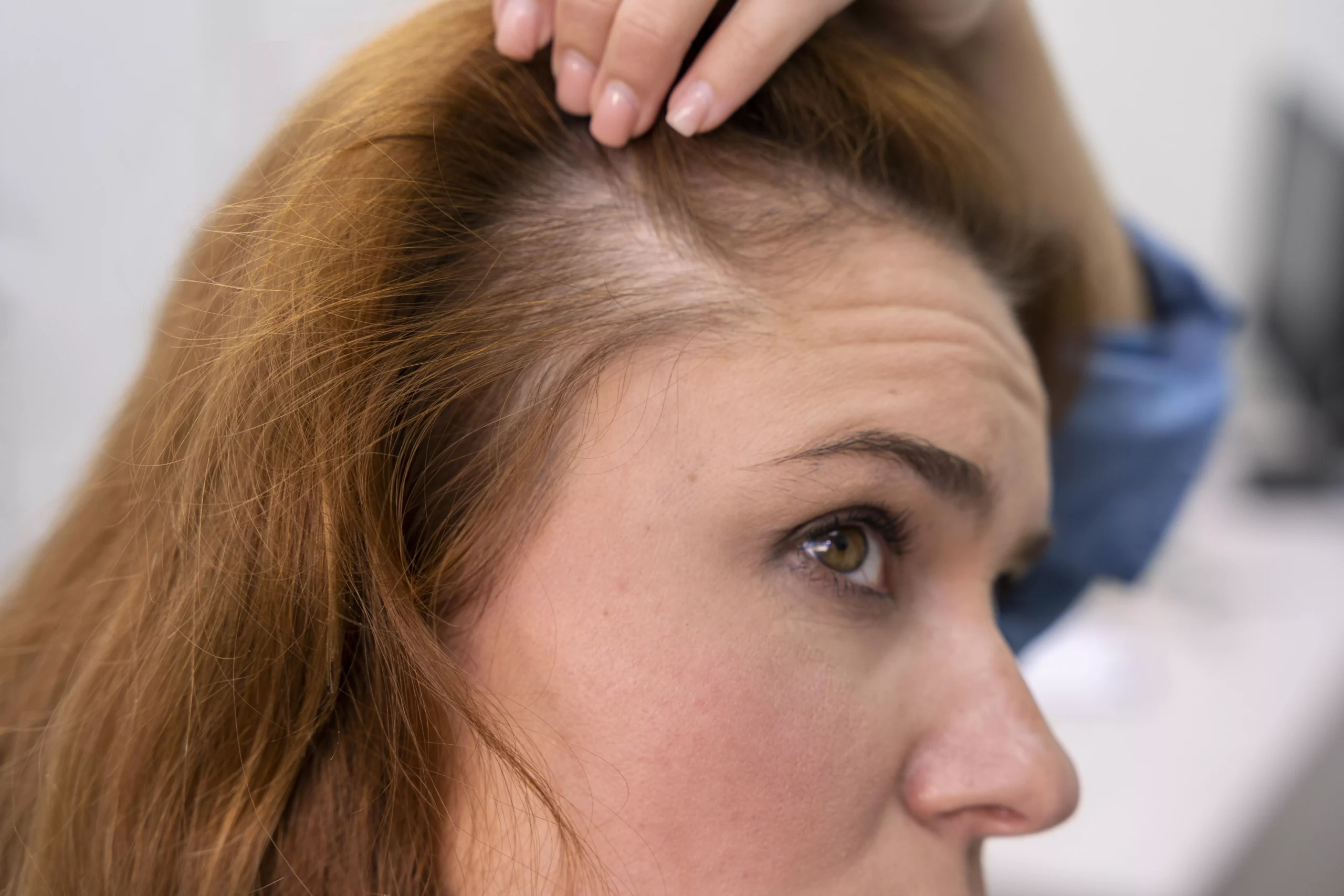 woman hair loss treatment clinic