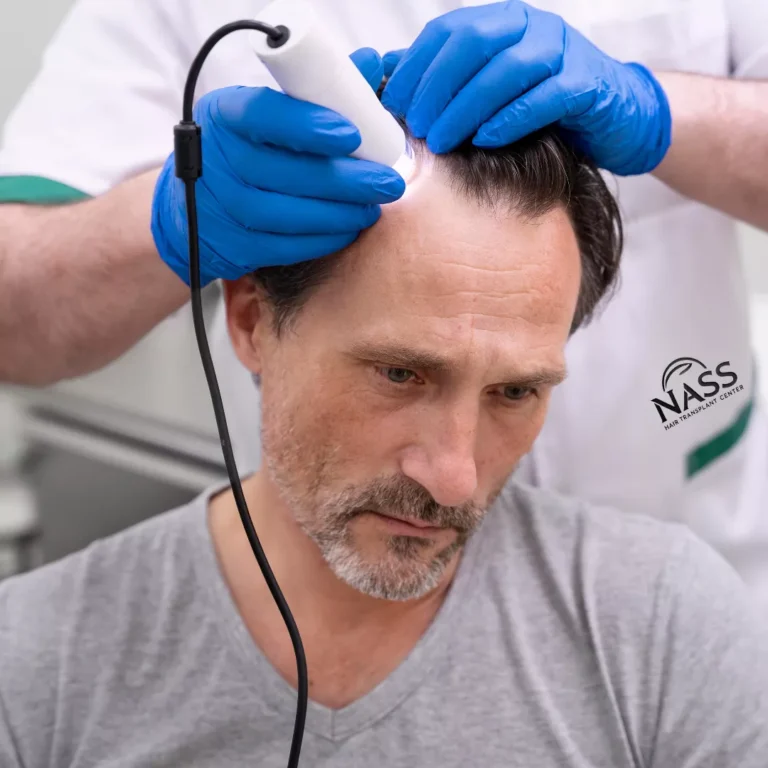 Prepping for a hair transplant